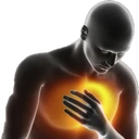 Heartburn